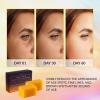 imageVALITIC Kojic Acid Dark Spot Remover Soap Bars with Vitamin C Retinol Collagen Turmeric  Original Japanese Complex Infused with Hyaluronic Acid Vitamin E Shea Butter Castile Olive Oil 2 Pack5 Pack