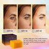 imageVALITIC Kojic Acid Dark Spot Remover Soap Bars with Vitamin C Retinol Collagen Turmeric  Original Japanese Complex Infused with Hyaluronic Acid Vitamin E Shea Butter Castile Olive Oil 2 Pack3 Pack