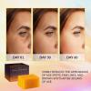 imageVALITIC Kojic Acid Soap for Hyperpigmentation  with Glutathione Collagen ampamp Vitamin C  Natural Soap Bars with Turmeric  Original Japanese Complex for Dark Spot Correction  2 Pack3 Pack
