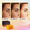 imageVALITIC Kojic Acid Vitamin C and Retinol Soap Bars with Turmeric for Dark Spot  Original Japanese Complex Infused with Collagen Hyaluronic Acid and Vitamin E 2 Pack3 Pack