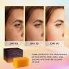 imageValitic 4 Pack Kojic Acid Dark Spot Corrector Soap Bars with Vitamin C Retinol Collagen Turmeric  Original Japanese Complex with Hyaluronic Acid ampamp A Pair of Black Exfoliating Gloves for Body Scrub2 Pack Hyal Soap Bars  Exfoliating Gloves