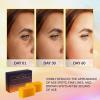 imageValitic 4 Pack Kojic Acid Dark Spot Corrector Soap Bars with Vitamin C Retinol Collagen Turmeric  Original Japanese Complex with Hyaluronic Acid ampamp A Pair of Black Exfoliating Gloves for Body Scrub4 Pack Hyal Soap Bars  Exfoliating Gloves