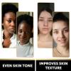 imageVALITIC Charcoal Kojic Acid Turmeric Black Soap Bar Dark Spot Remover for Body or Face Wash  2 Pack and African Net Sponge