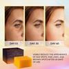 image:imageVALITIC Kojic Acid Dark Spot Corrector Soap Bars with Vitamin C Retinol Collagen Turmeric  Original Japanese Complex  Hyaluronic Acid Vitamin E Shea Butter Castile Olive Oil  2 Pack With Bag3 Pack