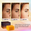 image:imageVALITIC Kojic Acid Dark Spot Corrector Soap Bars with Vitamin C Retinol Collagen Turmeric  Original Japanese Complex  Hyaluronic Acid Vitamin E Shea Butter Castile Olive Oil  2 Pack With Bag3 Pack  Bag