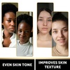 image:imageVALITIC Charcoal Kojic Acid Turmeric Black Soap Bar Dark Spot Remover for Body or Face Wash  2 Pack and Bag4 Pack